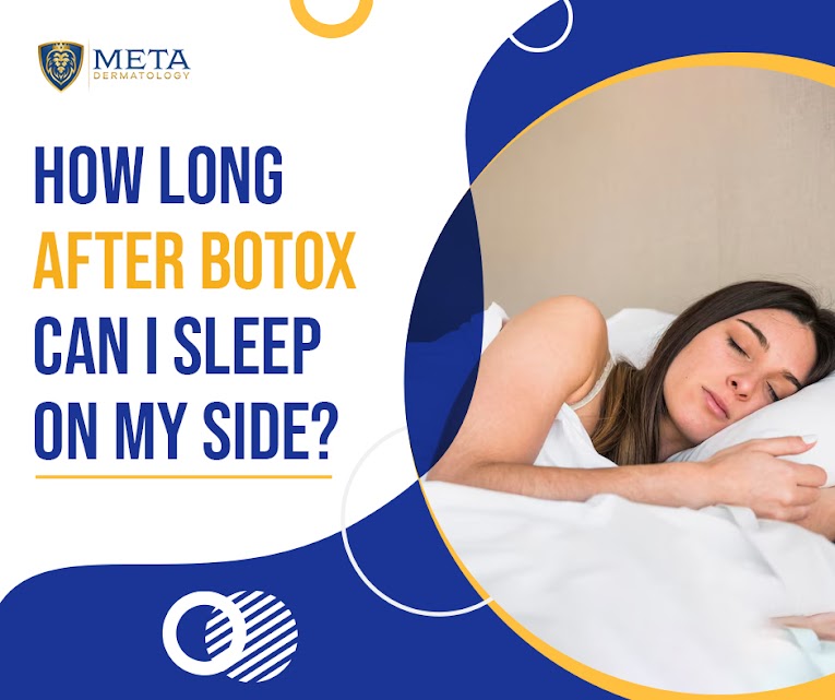 How long after Botox can I sleep on my side