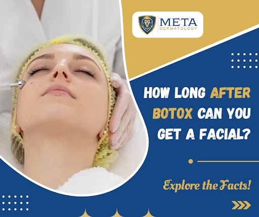 How long after Botox can you get a facial