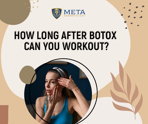 How long after Botox can you workout
