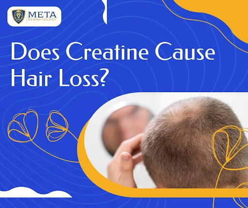 Does creatine cause hair loss