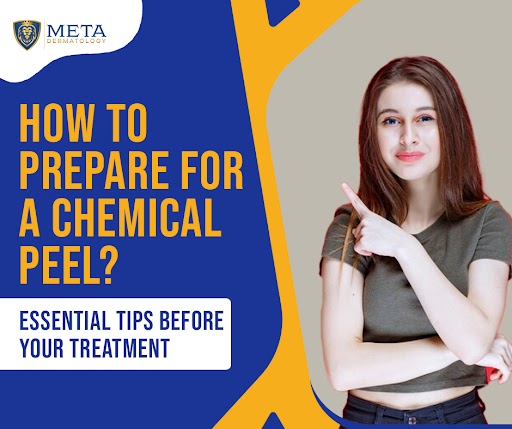 how to prepare for a chemical peel
