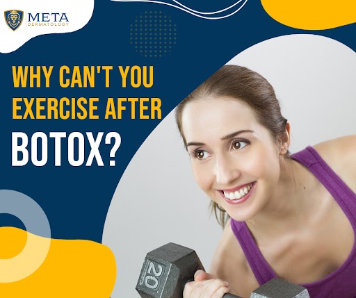 why can't you exercise after botox