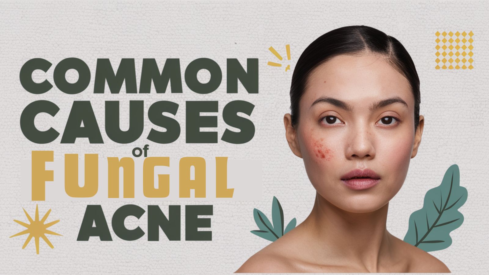 Common causes of fungal acne