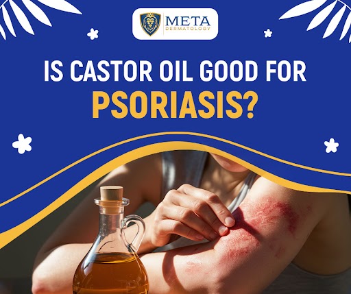 is castor oil good psoriasis
