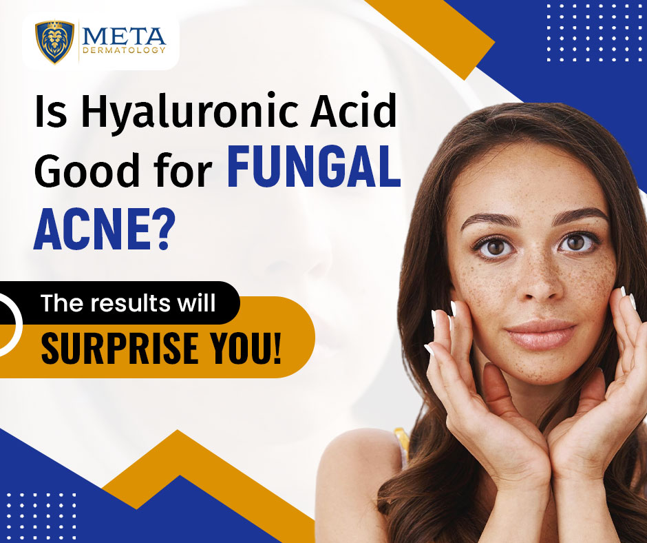 is hyaluronic acid good for fungal acne