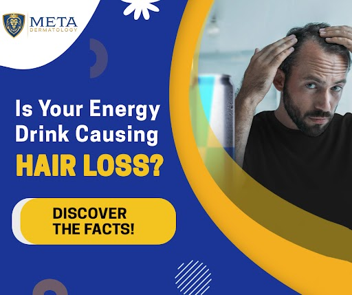 Do energy drink cause hair loss