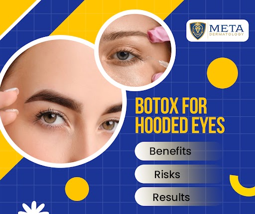 Botox for hooded for eyes