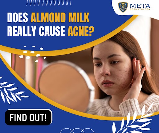 can almond milk cause acne