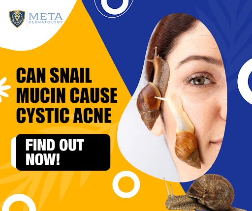 can snail mucin cause cystic acne