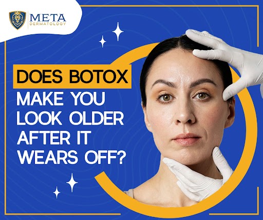 Does Botox Make You Look Older After it Wears Off