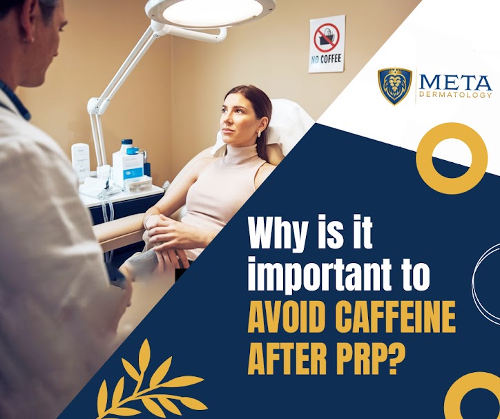 Why no caffeine after PRP