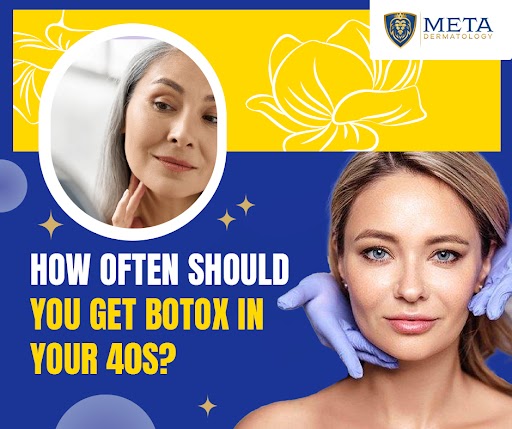 how often should you get botox in your 40s