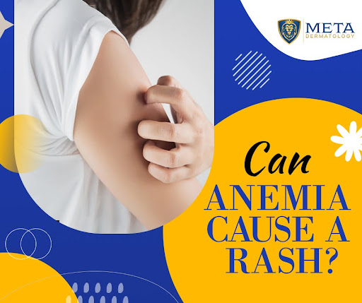 Can Anemia Cause a Rash