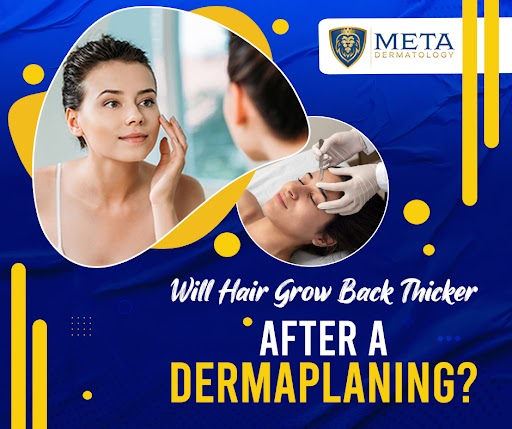 Does dermaplaning make hair grow